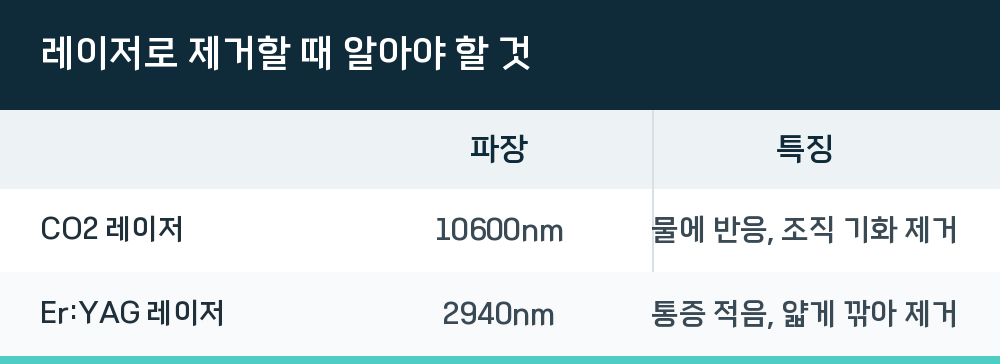 레이저로 제거할 때 알아야 할 것