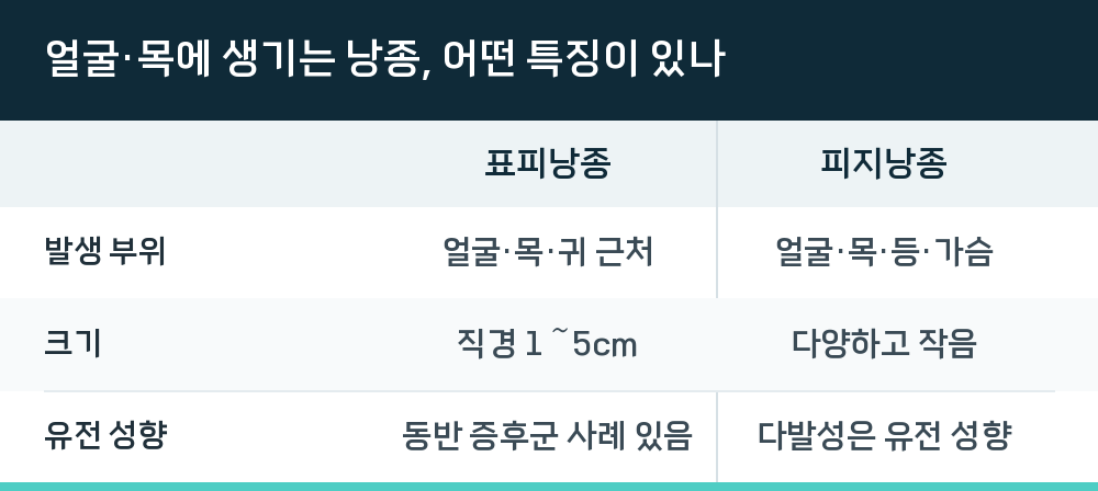 얼굴·목에 생기는 낭종, 어떤 특징이 있나